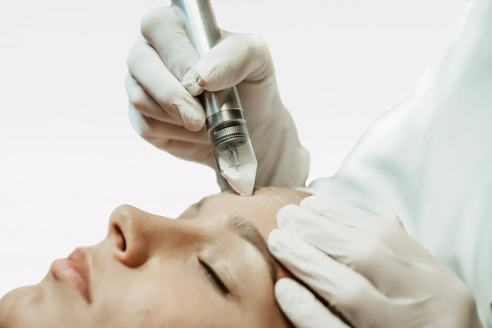 Mikrodermabrasion mit dem REVIDERM Skin Peeler bei BodyFlair Werdau