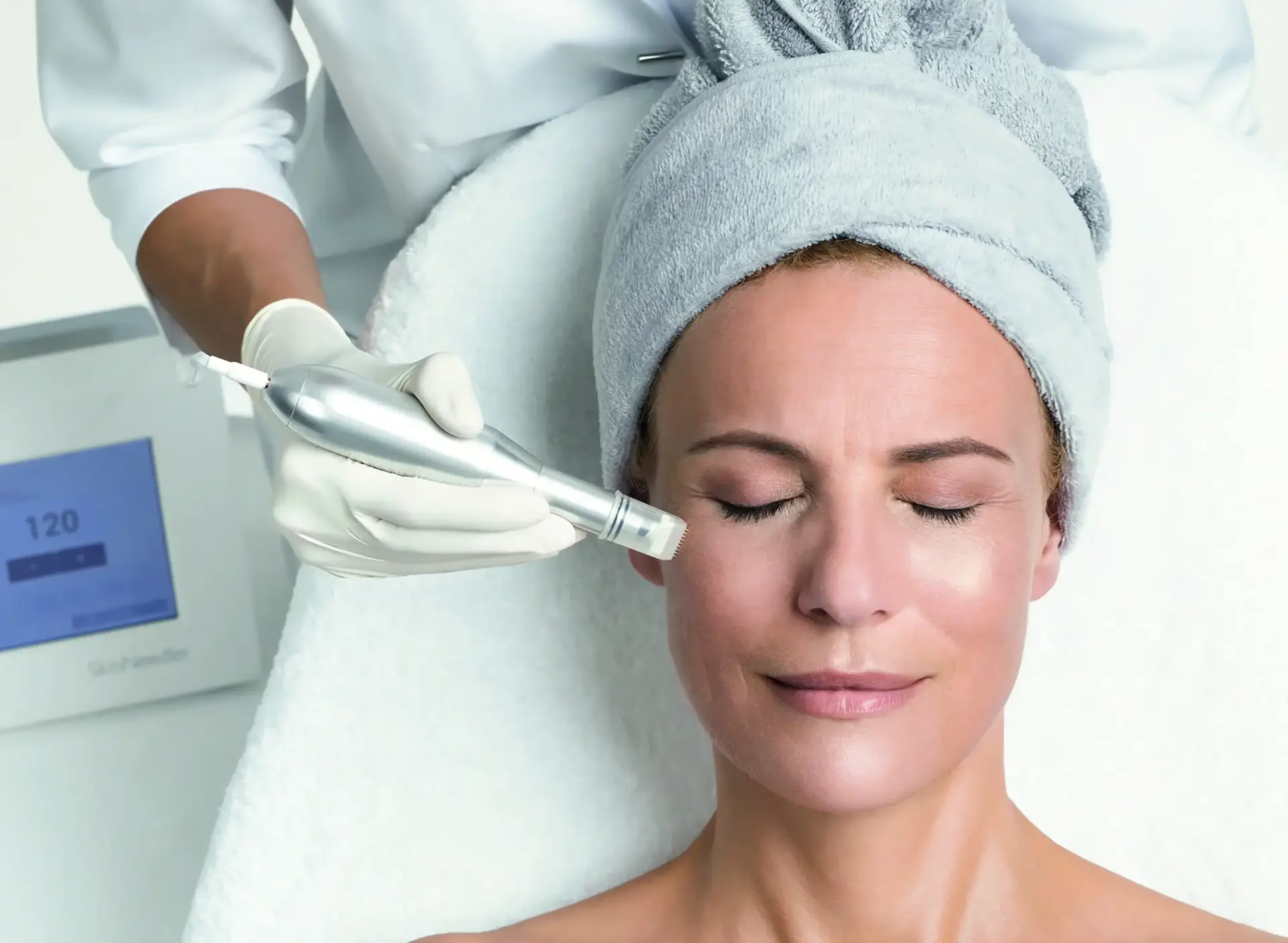 MicroNeedling-Behandlung mit dem REVIDERM SkinNeedler bei BodyFlair Werdau
