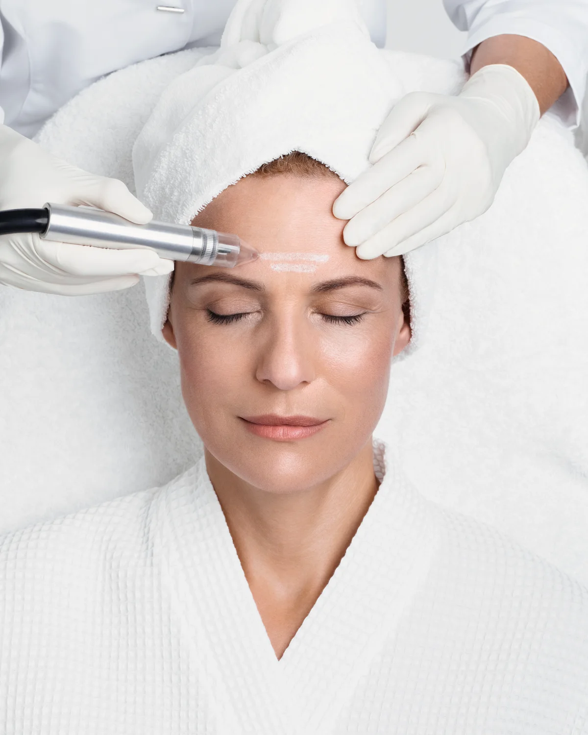 Mikrodermabrasion am Gesicht: das Handstück des REVIDERM Skin Peelers führt über die Stirn